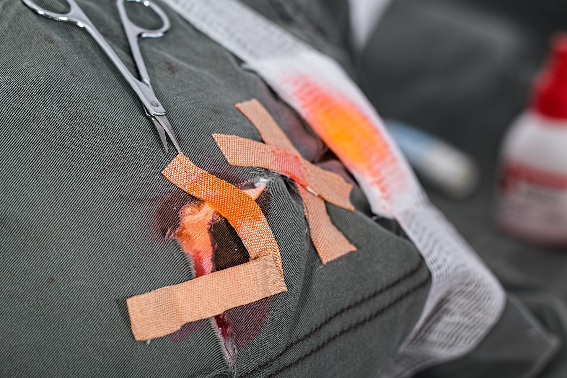 dealing with severe bleeding